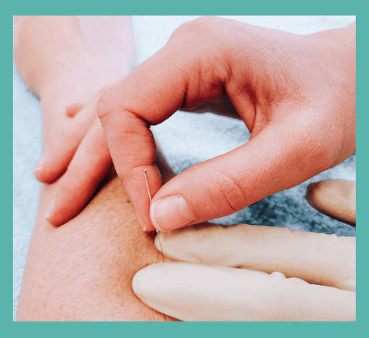 Dry Needling bij Fysiotherapie Centrum Amsterdam